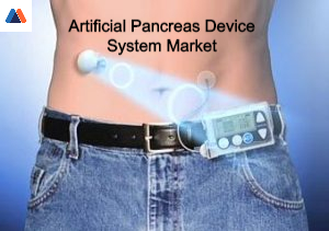 artificial pancreas device system market