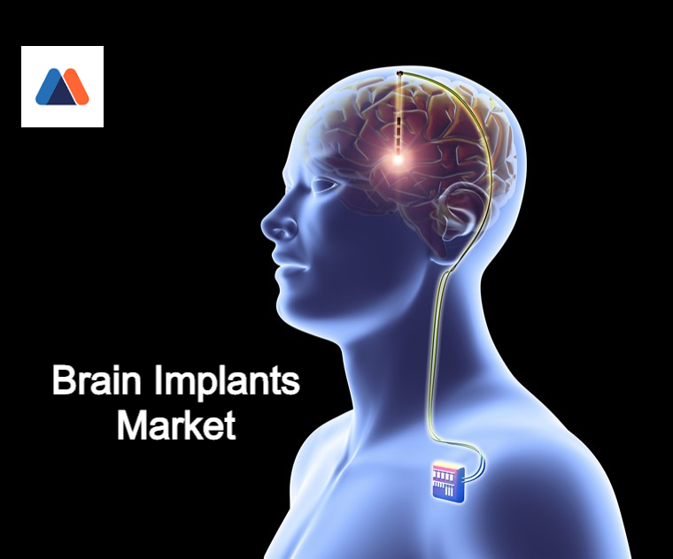 brain implants market